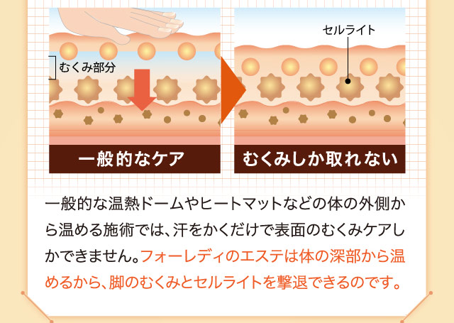一般的な温熱ドームやヒートマットなどの体の外側から温める施術では、汗をかくだけで表面のむくみケアしかできません。フォーレディのエステは体の深部から温めるから、脚のむくみとセルライトを撃退できるのです。