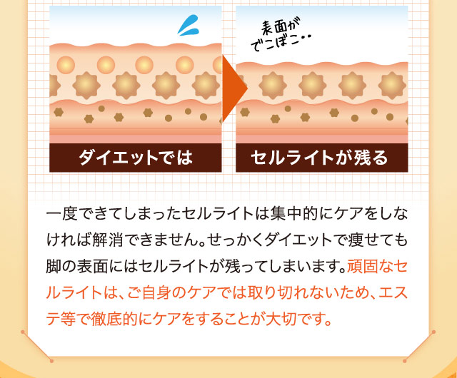 一度できてしまったセルライトは集中的にケアをしなければ解消できません。せっかくダイエットで痩せても脚の表面にはセルライトが残ってしまいます。頑固なセルライトは、ご自身のケアでは取り切れないため、エステ等で徹底的にケアをすることが大切です。